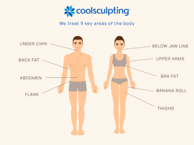 Cool sculpting chester